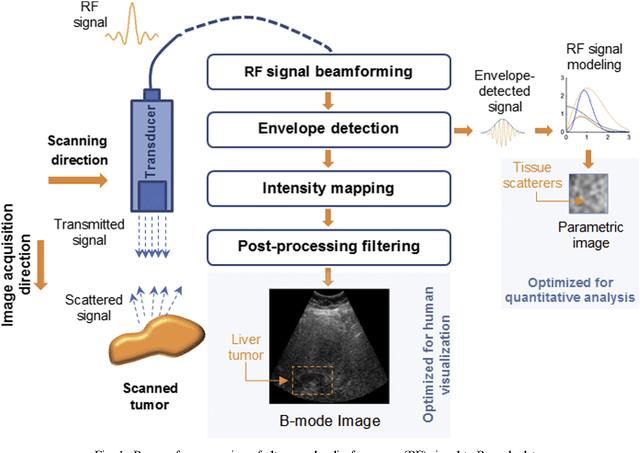 Figure 1 for Heterogeneous tissue characterization using ultrasound: a comparison of fractal analysis backscatter models on liver tumors