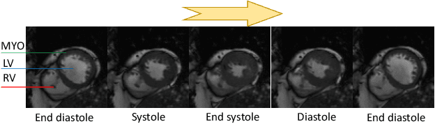 Figure 1 for FOAL: Fast Online Adaptive Learning for Cardiac Motion Estimation