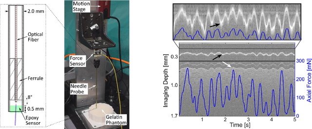 Figure 1 for A novel optical needle probe for deep learning-based tissue elasticity characterization