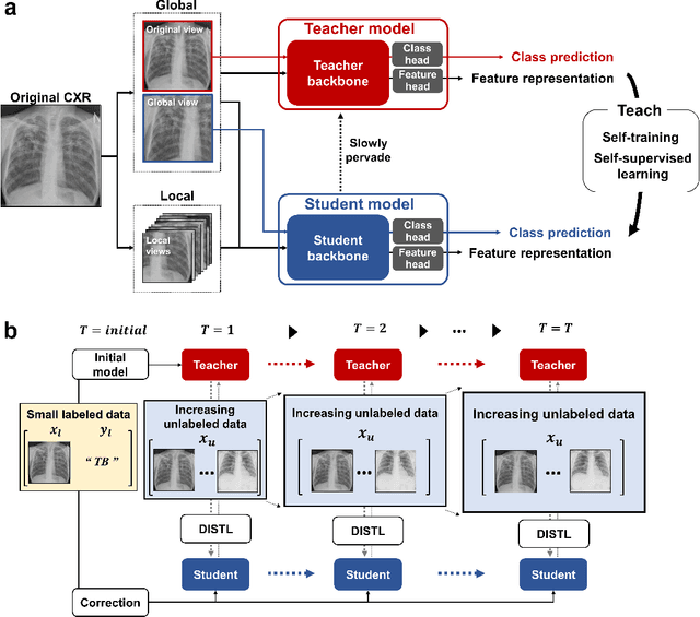 Figure 1 for AI can evolve without labels: self-evolving vision transformer for chest X-ray diagnosis through knowledge distillation
