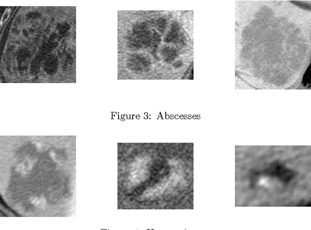 Figure 4 for Classification of Hepatic Lesions using the Matching Metric