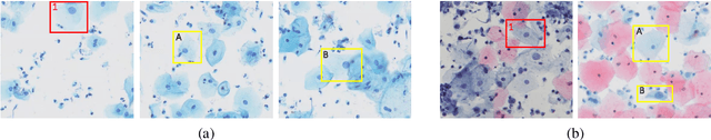 Figure 1 for Exploring Contextual Relationships for Cervical Abnormal Cell Detection