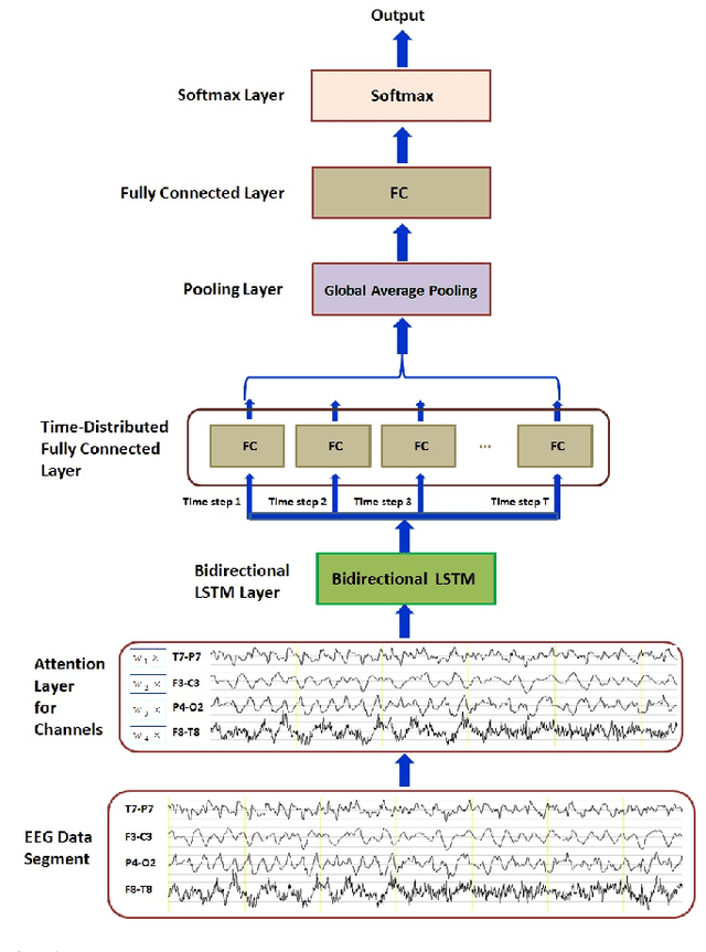 Figure 1 for A Robust Deep Learning Approach for Automatic Seizure Detection