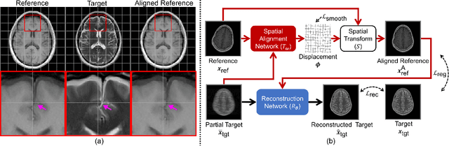 Figure 1 for Multi-Modal MRI Reconstruction Assisted with Spatial Alignment Network