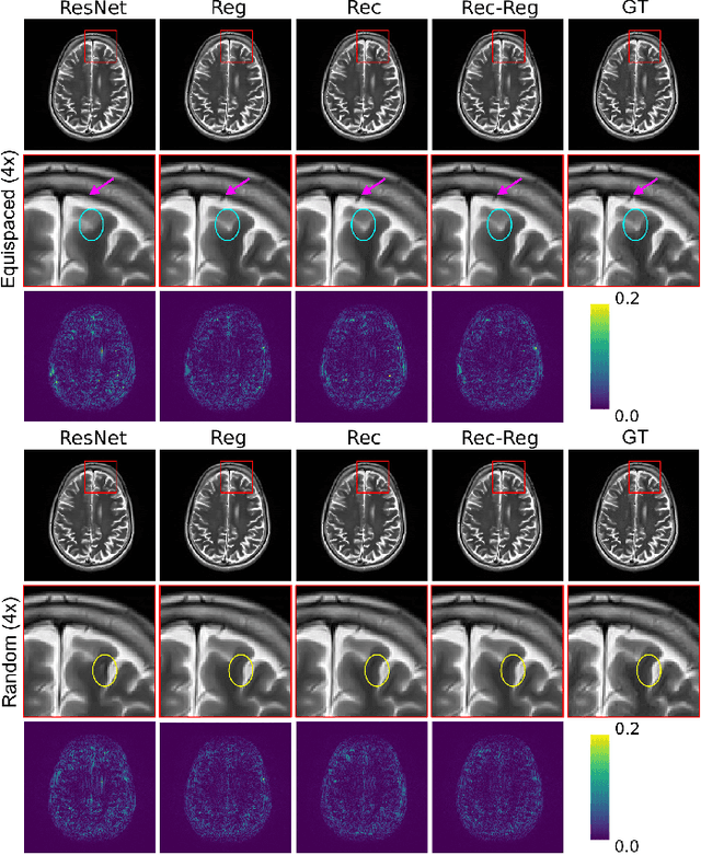 Figure 4 for Multi-Modal MRI Reconstruction Assisted with Spatial Alignment Network
