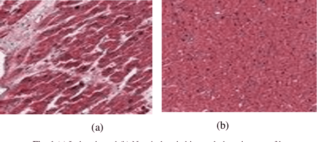 Figure 1 for Self-attention based BiLSTM-CNN classifier for the prediction of ischemic and non-ischemic cardiomyopathy