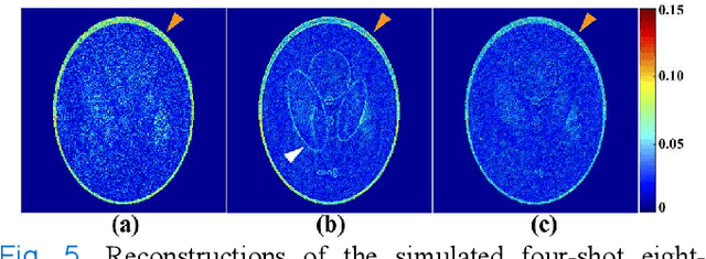 Figure 4 for A Paired Phase and Magnitude Reconstruction for Advanced Diffusion-Weighted Imaging
