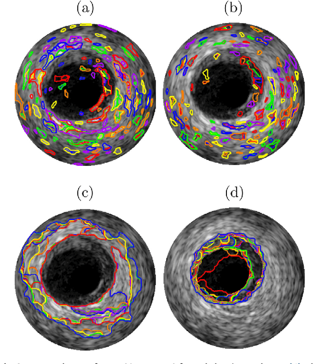 Figure 3 for Segmentation of Arterial Walls in Intravascular Ultrasound Cross-Sectional Images Using Extremal Region Selection