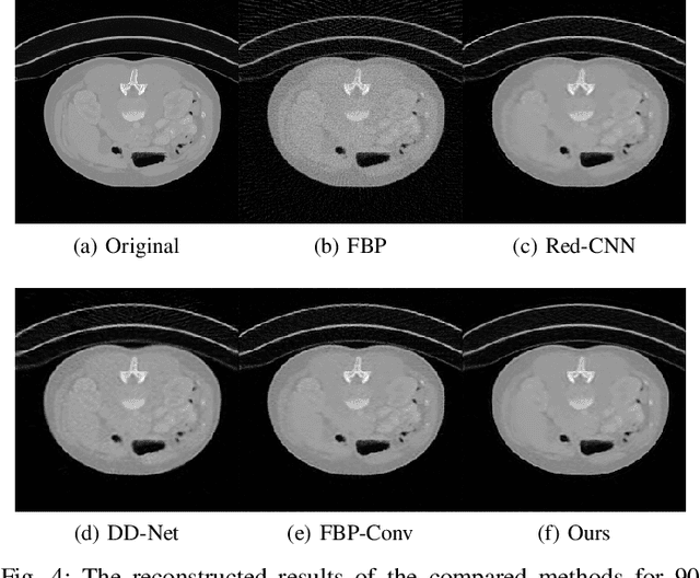 Figure 4 for A deep network for sinogram and CT image reconstruction