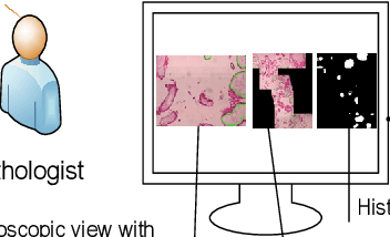 Figure 4 for A Semantic Segmentation Network Based Real-Time Computer-Aided Diagnosis System for Hydatidiform Mole Hydrops Lesion Recognition in Microscopic View