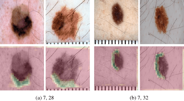 Figure 1 for Visualizing Convolutional Neural Networks to Improve Decision Support for Skin Lesion Classification