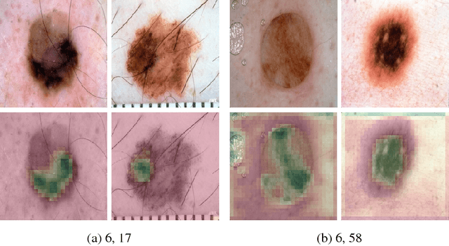 Figure 2 for Visualizing Convolutional Neural Networks to Improve Decision Support for Skin Lesion Classification