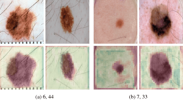 Figure 3 for Visualizing Convolutional Neural Networks to Improve Decision Support for Skin Lesion Classification