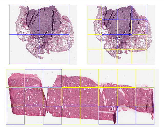 Figure 4 for Deep Features for Tissue-Fold Detection in Histopathology Images