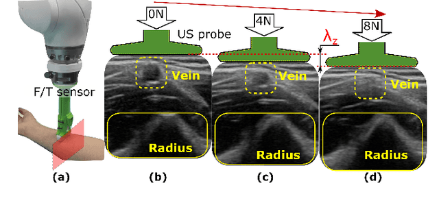 Figure 1 for Deformation-Aware Robotic 3D Ultrasound