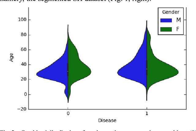 Figure 4 for Chest X-Ray Analysis of Tuberculosis by Deep Learning with Segmentation and Augmentation