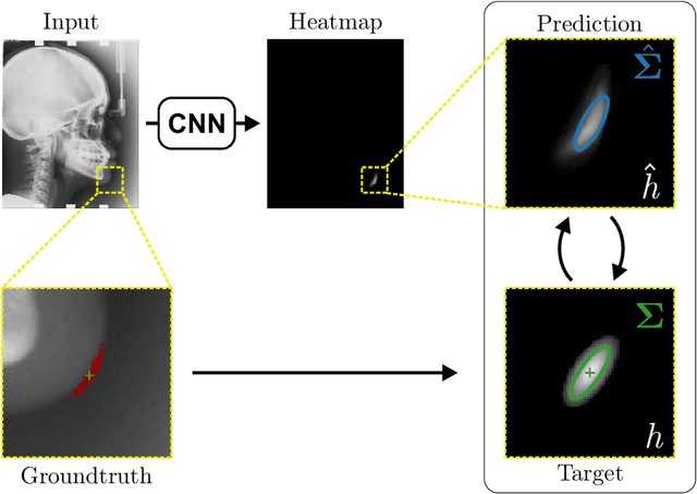 Figure 1 for Modeling Annotation Uncertainty with Gaussian Heatmaps in Landmark Localization