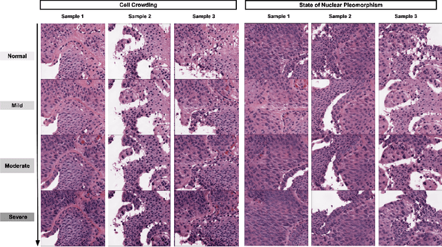 Figure 3 for A Multi-attribute Controllable Generative Model for Histopathology Image Synthesis