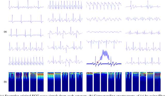 Figure 3 for Fine-grained ECG Classification Based on Deep CNN and Online Decision Fusion
