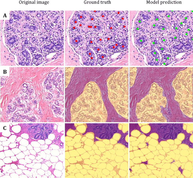 Figure 3 for Deep learning assessment of breast terminal duct lobular unit involution: towards automated prediction of breast cancer risk