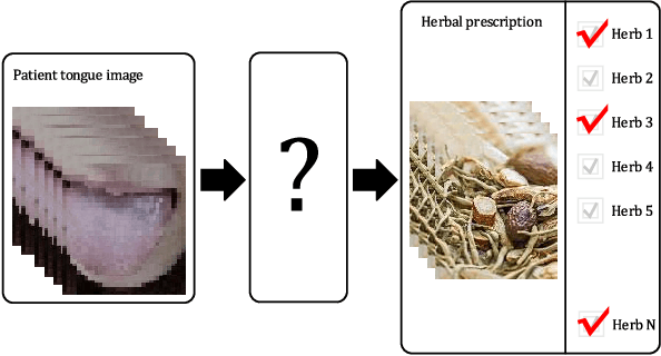 Figure 1 for Automatic construction of Chinese herbal prescription from tongue image via CNNs and auxiliary latent therapy topics