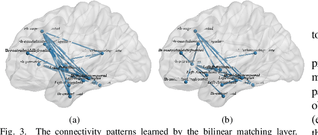 Figure 3 for Integrative Analysis of Patient Health Records and Neuroimages via Memory-based Graph Convolutional Network