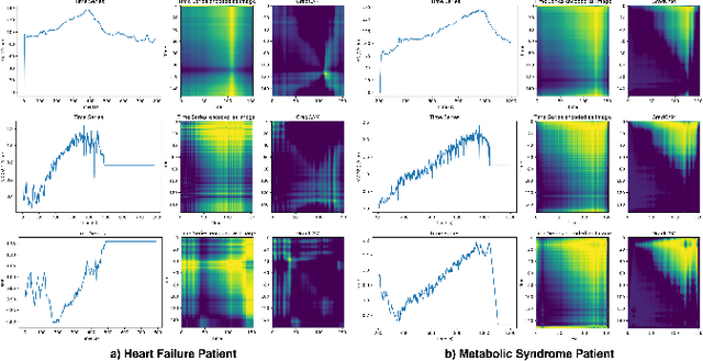 Figure 4 for Encoding Cardiopulmonary Exercise Testing Time Series as Images for Classification using Convolutional Neural Network