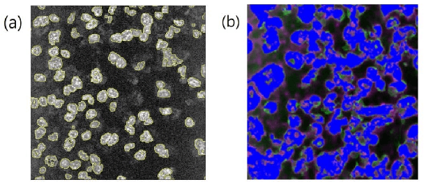 Figure 3 for Boundary-Preserved Deep Denoising of the Stochastic Resonance Enhanced Multiphoton Images