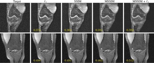 Figure 3 for An Adaptive Intelligence Algorithm for Undersampled Knee MRI Reconstruction: Application to the 2019 fastMRI Challenge