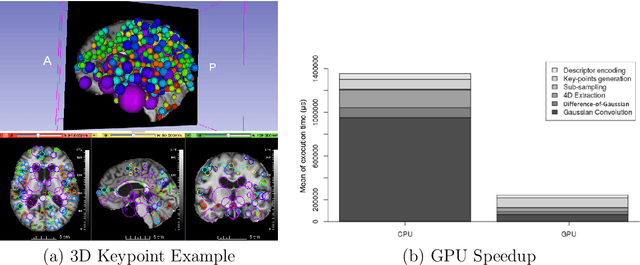 Figure 1 for GPU optimization of the 3D Scale-invariant Feature Transform Algorithm and a Novel BRIEF-inspired 3D Fast Descriptor