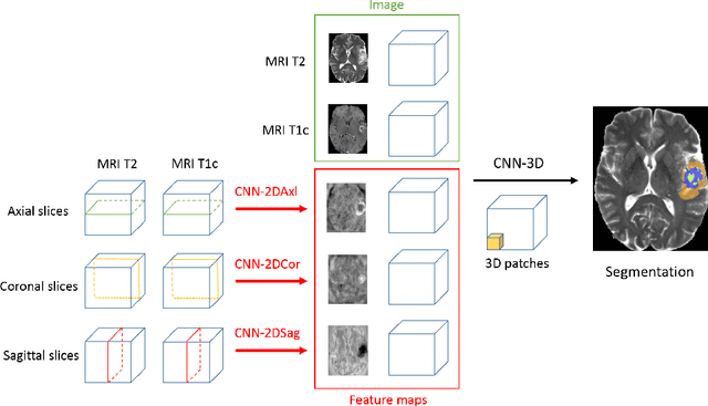 Figure 3 for 3D Convolutional Neural Networks for Tumor Segmentation using Long-range 2D Context