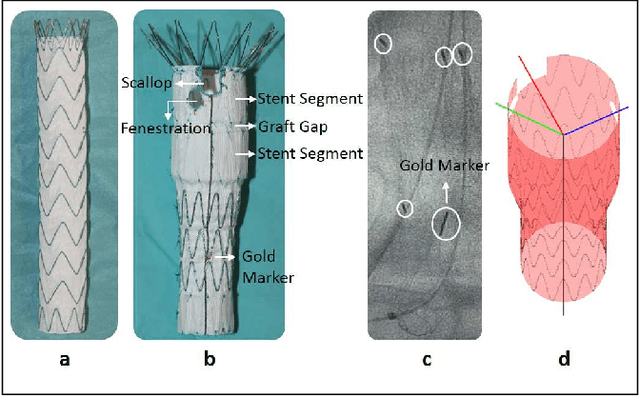 Figure 1 for Real-time 3D Shape Instantiation from Single Fluoroscopy Projection for Fenestrated Stent Graft Deployment