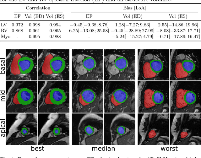 Figure 3 for An Exploration of 2D and 3D Deep Learning Techniques for Cardiac MR Image Segmentation