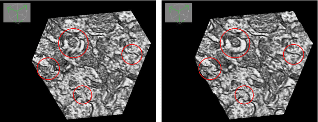 Figure 3 for ssEMnet: Serial-section Electron Microscopy Image Registration using a Spatial Transformer Network with Learned Features