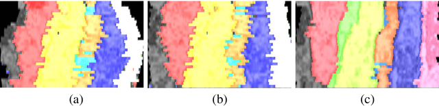 Figure 4 for ssEMnet: Serial-section Electron Microscopy Image Registration using a Spatial Transformer Network with Learned Features