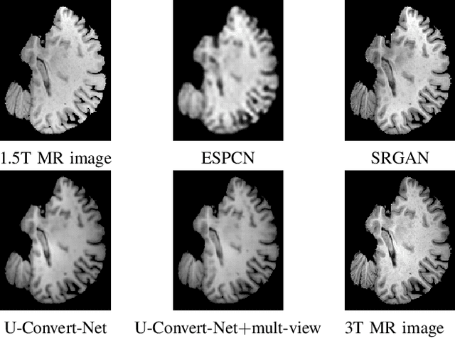 Figure 3 for A Comparative Study on 1.5T-3T MRI Conversion through Deep Neural Network Models