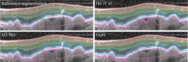 Figure 3 for SD-LayerNet: Semi-supervised retinal layer segmentation in OCT using disentangled representation with anatomical priors