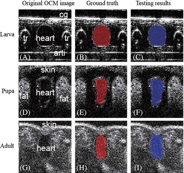 Figure 3 for Segmentation of Drosophila Heart in Optical Coherence Microscopy Images Using Convolutional Neural Networks