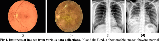 Figure 1 for Does deep learning model calibration improve performance in class-imbalanced medical image classification?