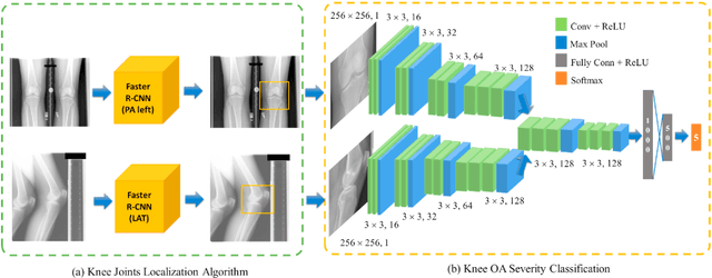 Figure 2 for Deep learning-based algorithm for assessment of knee osteoarthritis severity in radiographs matches performance of radiologists