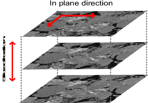Figure 1 for CT-image Super Resolution Using 3D Convolutional Neural Network