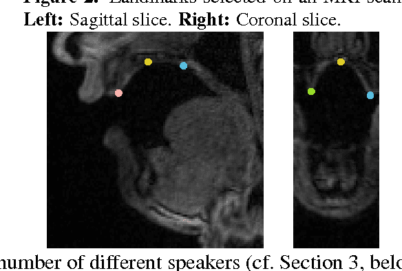 Figure 2 for A statistical shape space model of the palate surface trained on 3D MRI scans of the vocal tract