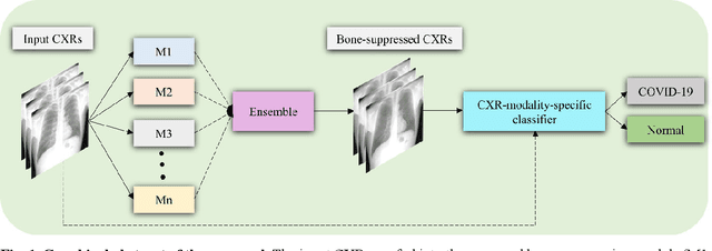 Figure 1 for A bone suppression model ensemble to improve COVID-19 detection in chest X-rays
