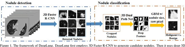 Figure 1 for DeepLung: Deep 3D Dual Path Nets for Automated Pulmonary Nodule Detection and Classification