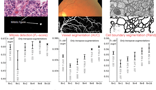Figure 3 for Roto-Translation Covariant Convolutional Networks for Medical Image Analysis