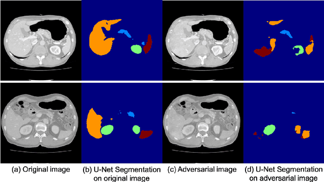 Figure 3 for Intelligent image synthesis to attack a segmentation CNN using adversarial learning
