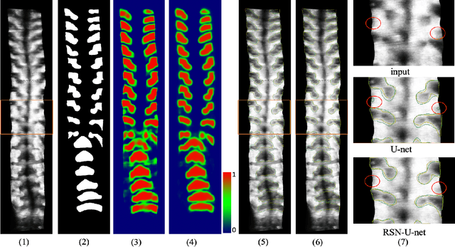 Figure 3 for Bone Feature Segmentation in Ultrasound Spine Image with Robustness to Speckle and Regular Occlusion Noise
