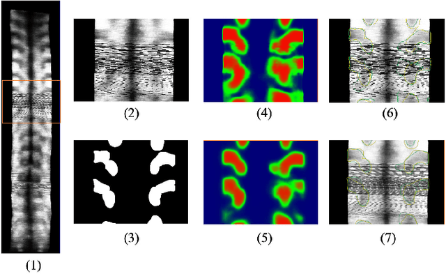 Figure 4 for Bone Feature Segmentation in Ultrasound Spine Image with Robustness to Speckle and Regular Occlusion Noise