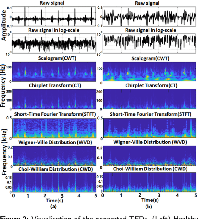 Figure 3 for Time-Frequency Distributions of Heart Sound Signals: A Comparative Study using Convolutional Neural Networks