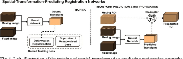Figure 1 for Conditional Segmentation in Lieu of Image Registration